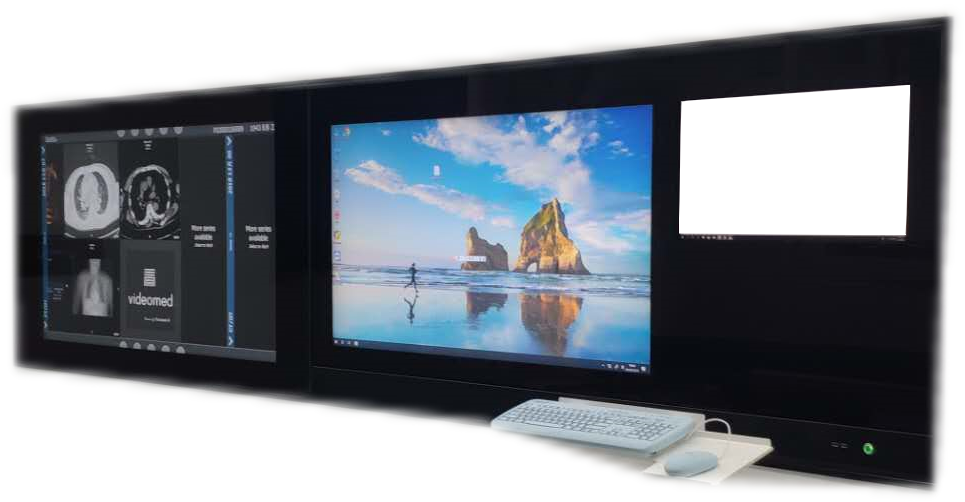 AIMBEL Intelligent touch screen